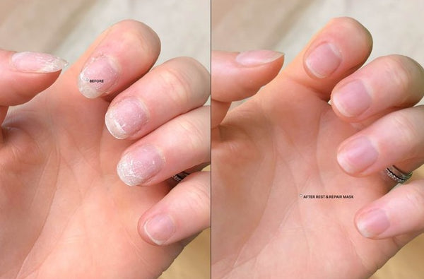 Serum Milagroso para Uñas